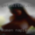 Women Naples vaginas
